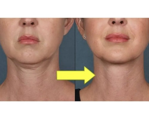 SADOER тканевая Neck Mask 25 мл